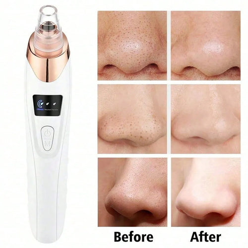 Aspirateur Points Noirs 2026 – Nettoyeur de Pores Facial 5 Niveaux de Succion, USB Rechargeable